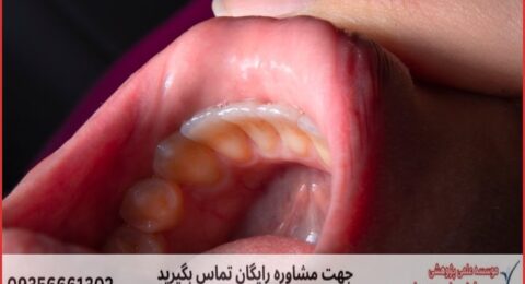 انجام پایان نامه تکنسین پروتزهای دندان
