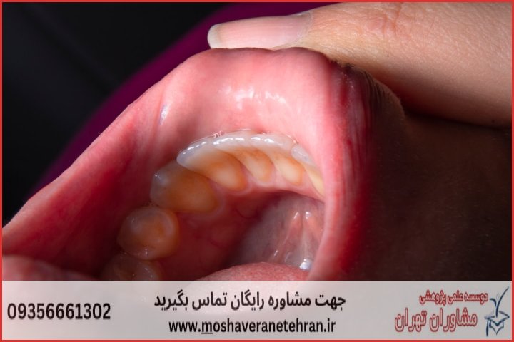 انجام پایان نامه تکنسین پروتزهای دندان