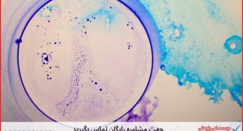 انجام پایان نامه زیست شناسی بیوتکنولوژی میکروبی + مشاوره و استعلام هزینه و قیمت نگارش