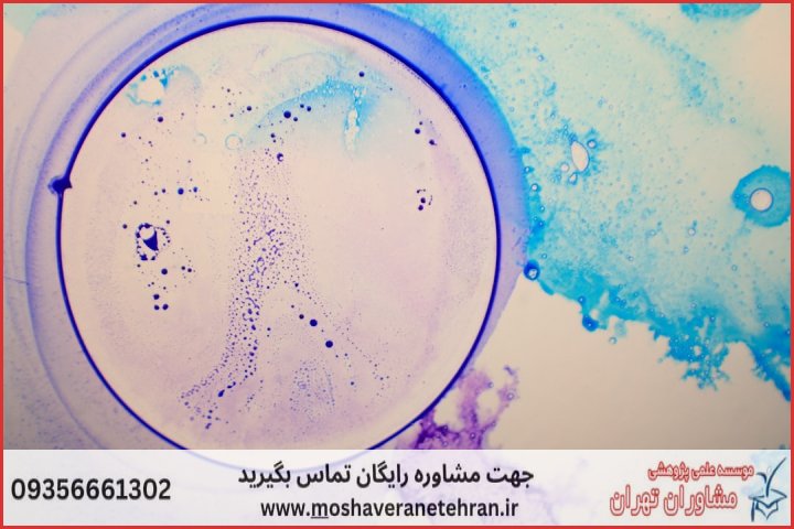 انجام پایان نامه زیست شناسی بیوتکنولوژی میکروبی + مشاوره و استعلام هزینه و قیمت نگارش